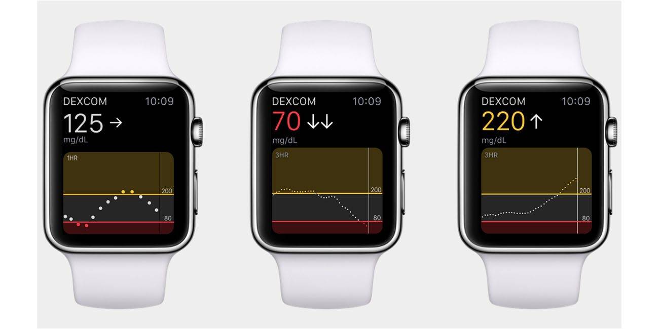 Apple-Watch-blood-sugar-measurement